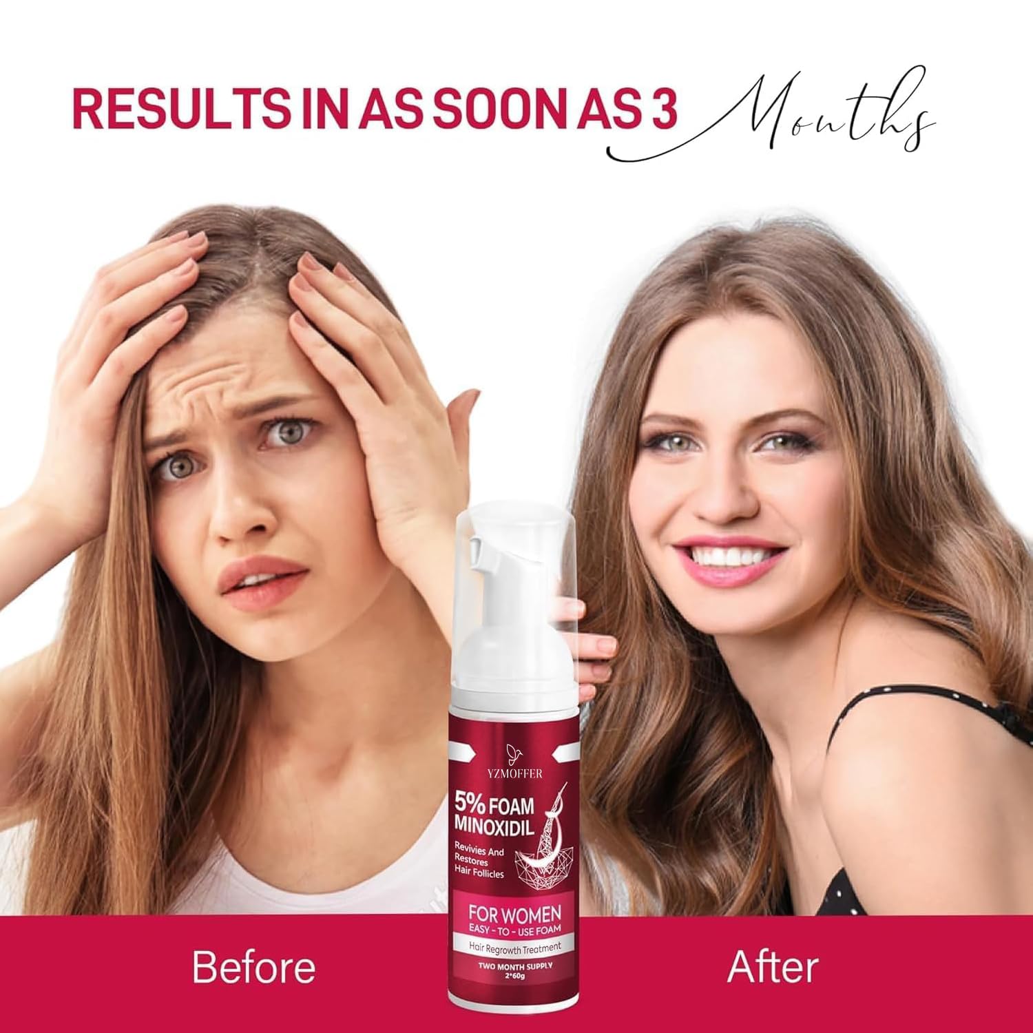 Yzmoffer Minoxidil Foam label detail emphasizes user-friendly dosing.