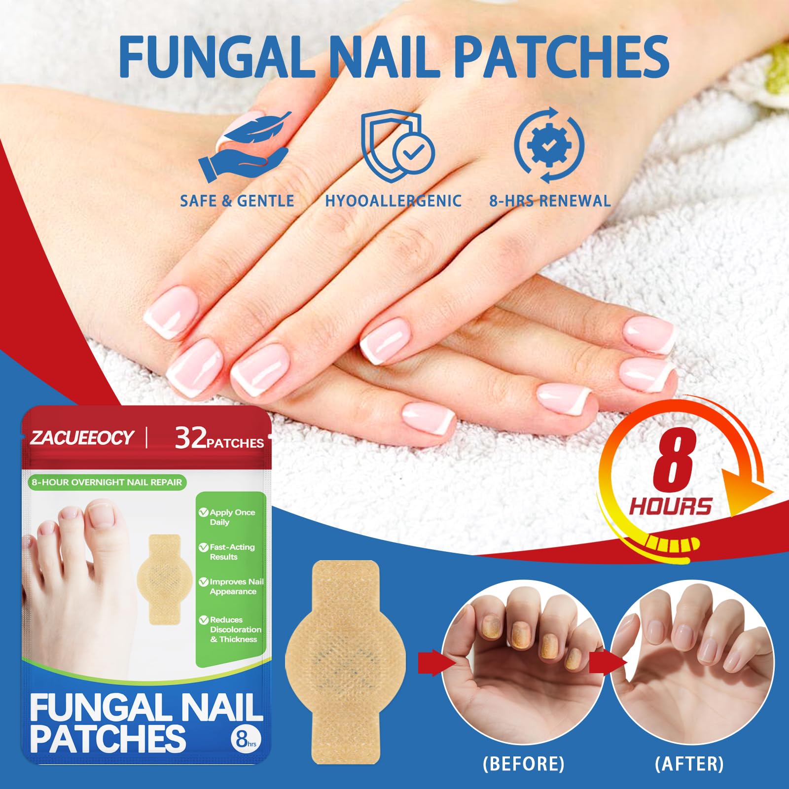 ZACUEEOCY Nail Fungus Patches on toenail during night use for repair.