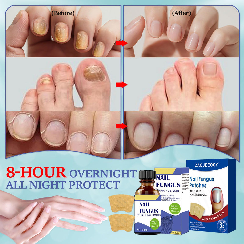 ZACUEEOCY 32-count nail renewal patches for continuous overnight care