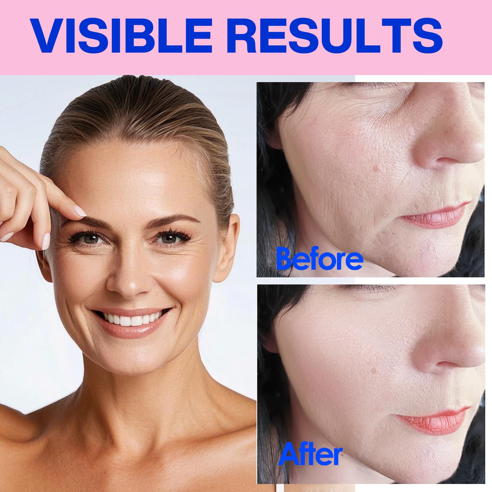 Zancony neck wrinkle patches provide subtle neck contouring support