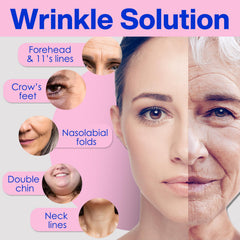 Zancony face tape for smile lines gently lifts facial contours