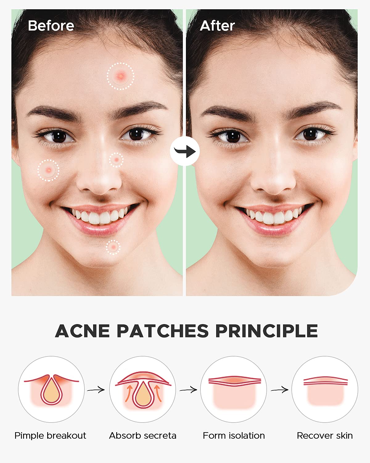 ZATKTK 10 mm patch provides medium coverage for mid-size spots