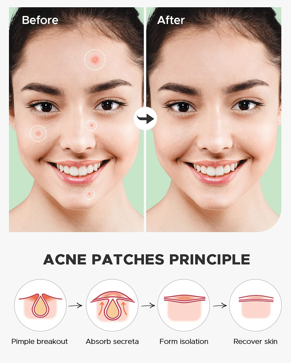 ZATKTK 10 mm patch provides medium coverage for mid-size spots