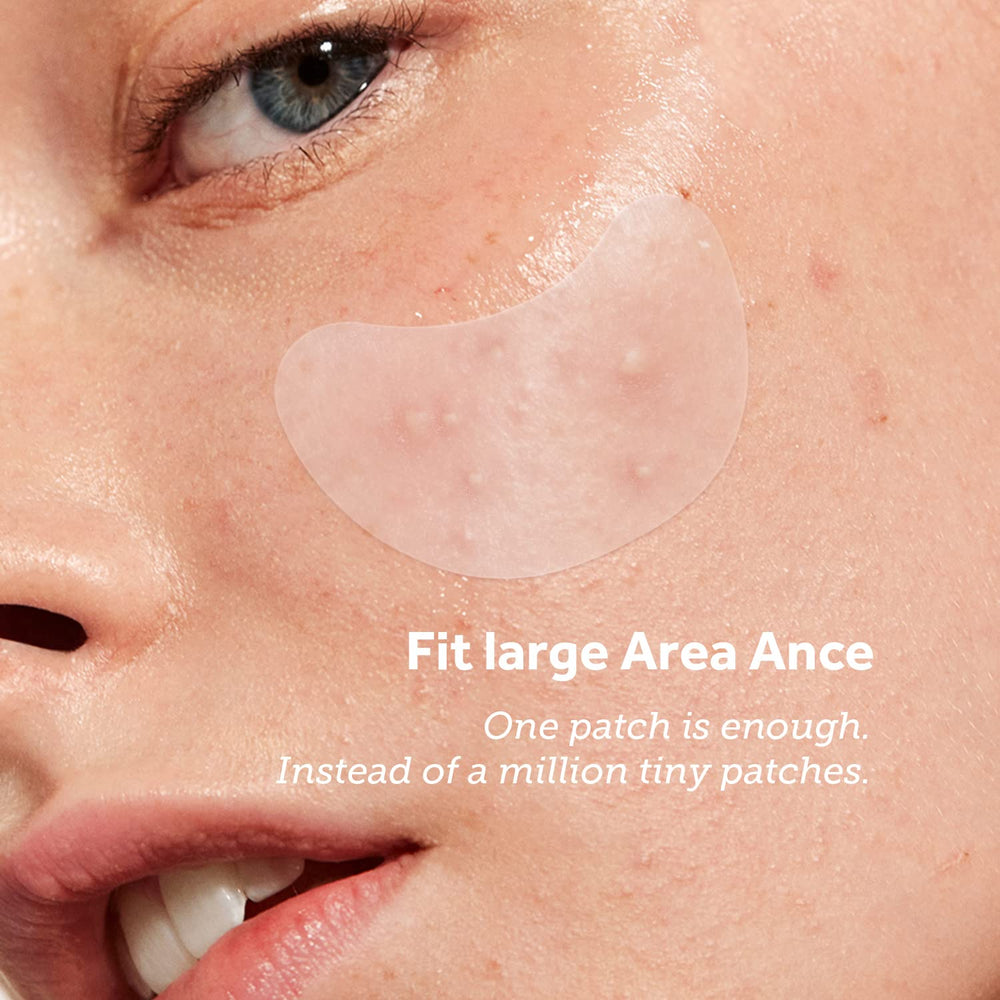 ZATKTK Pimple Patches tea tree oil infused for gentle soothing.