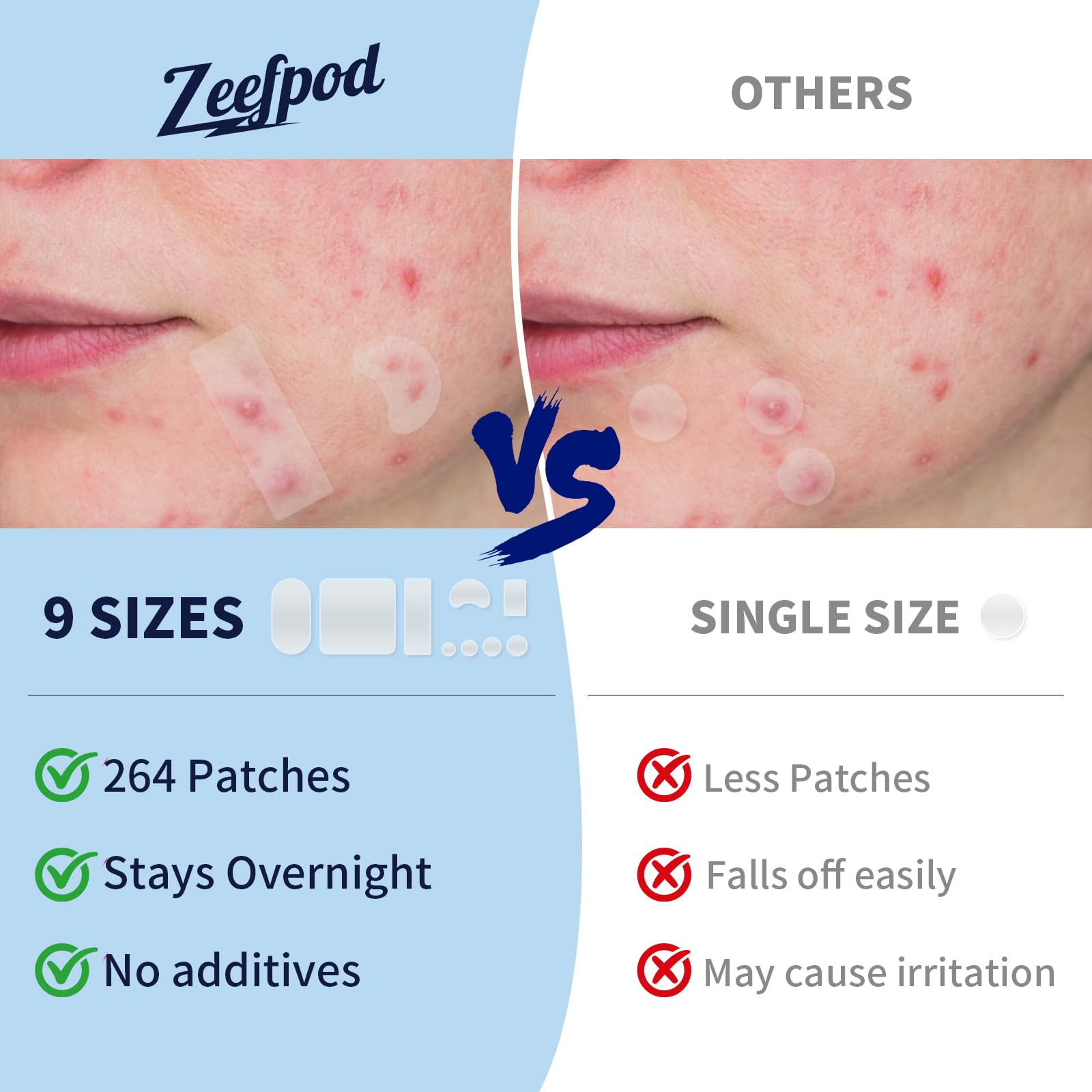Zeefpod 264-count kit supports multiple breakouts and ongoing routines.