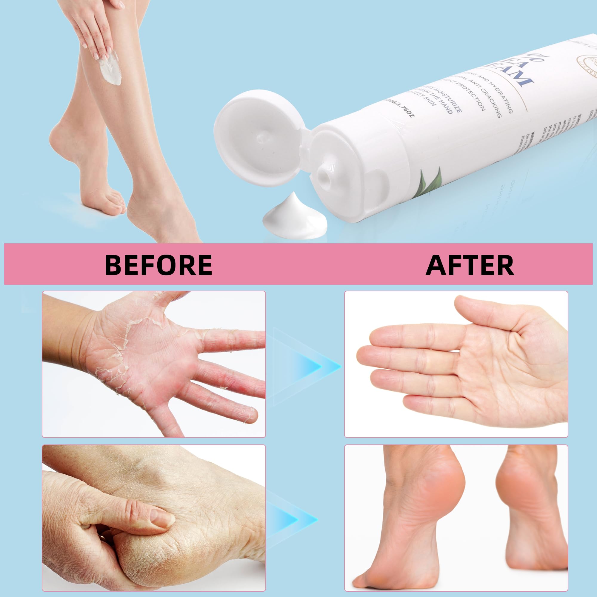 Zegrox Urea Cream 40% foot care application scene showing easy spread.