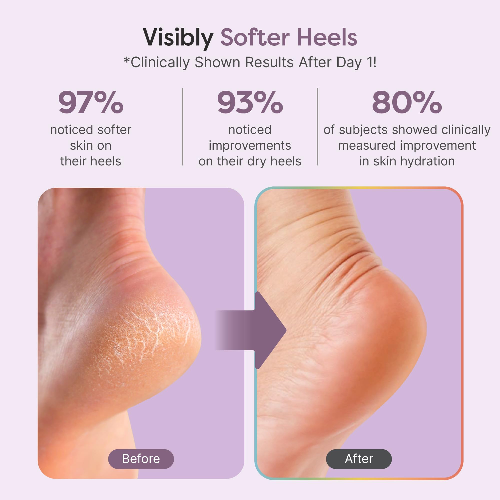 Texture swatch of ZenToes foot balm reveals thick, balm-like formula for deep moisturization.