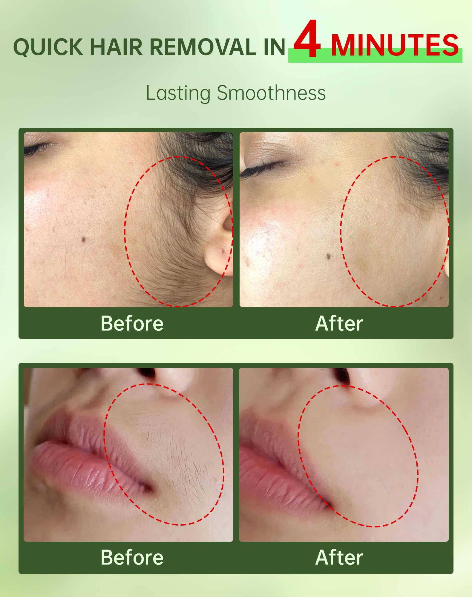 Zeponyx 2-in-1 kit with soothing cream for post-removal calm.
