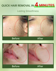 Zeponyx 2-in-1 kit with soothing cream for post-removal calm.