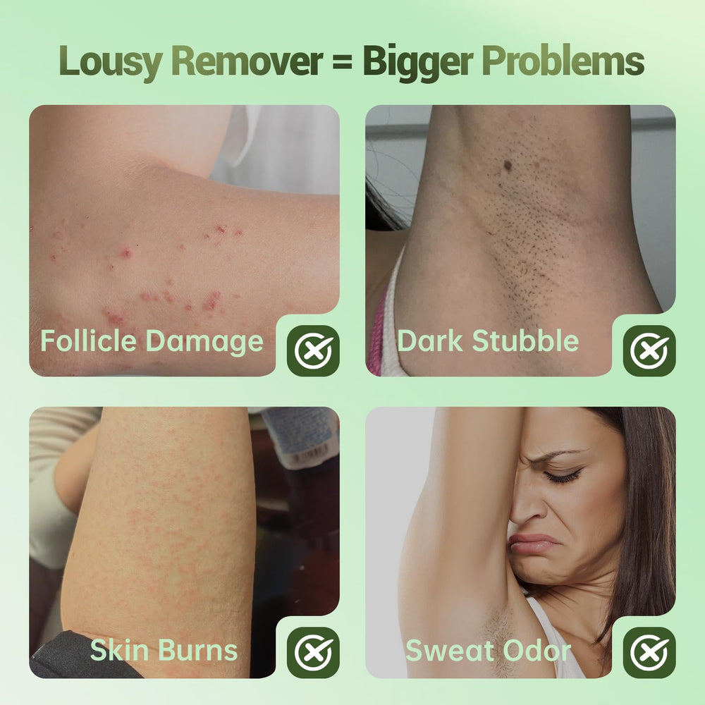 Zeponyx Hair Removal Cream 10-minute timer suggests fast results.