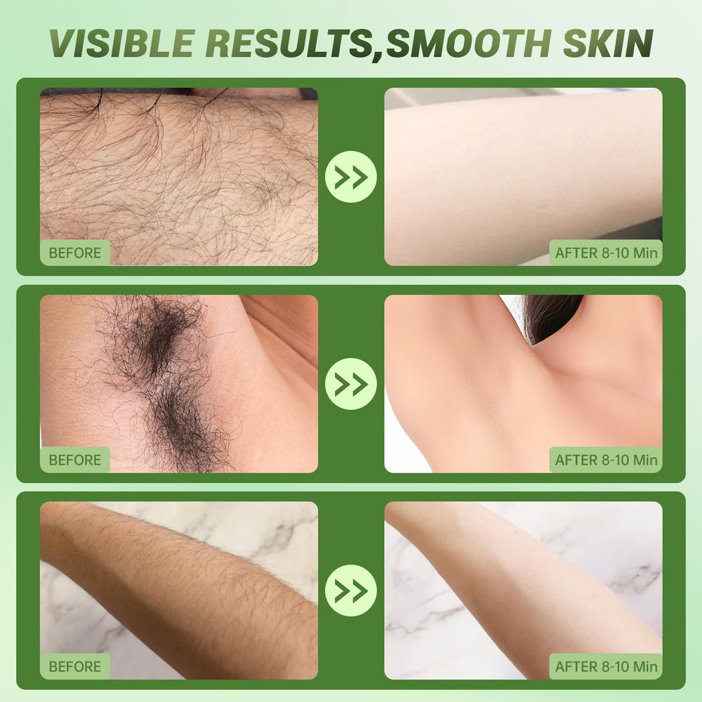 Zeponyx Hair Removal Cream underarms application for quick, painless use.