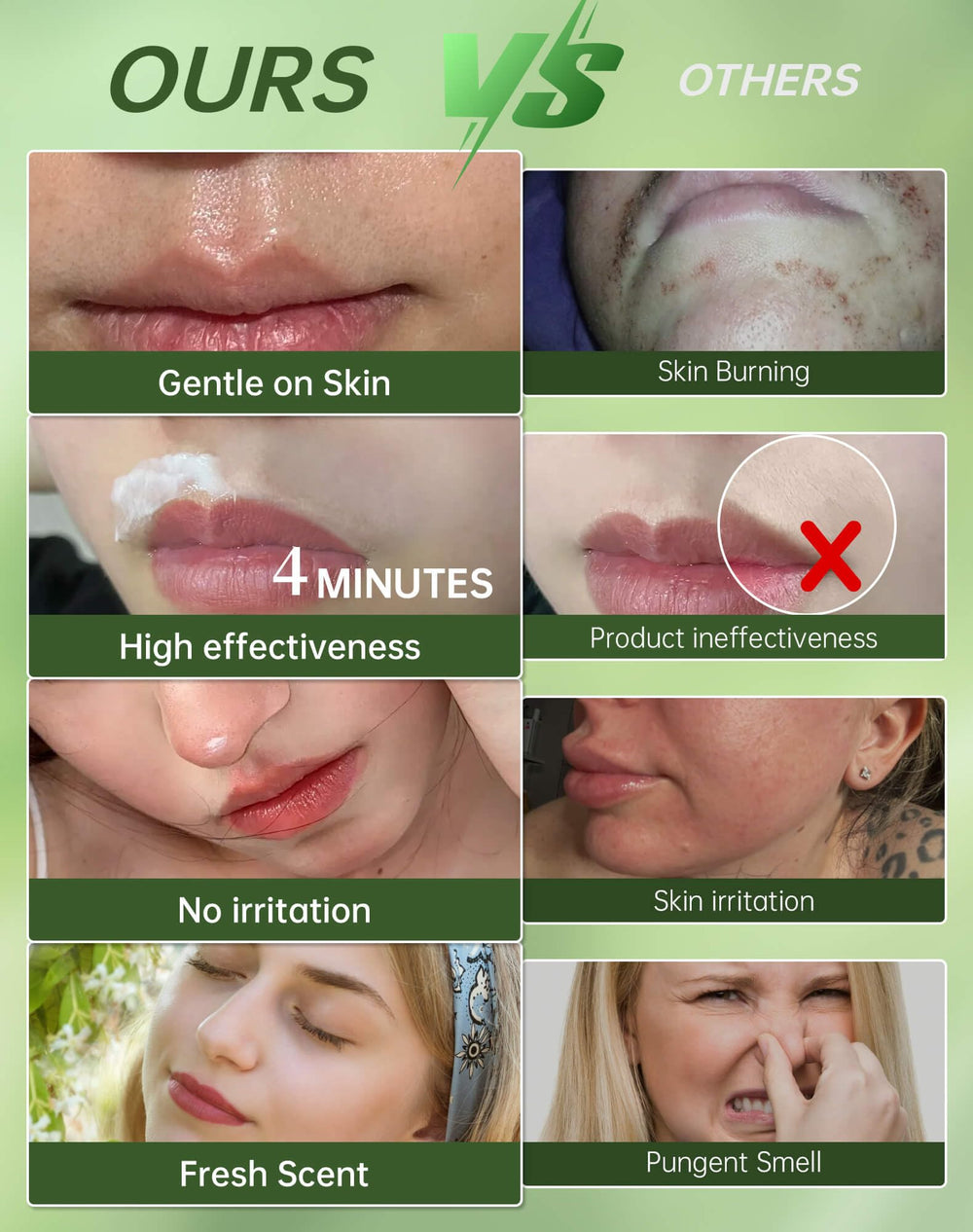 Zeponyx soothing cream with ceramide NP and panthenol protects sensitive skin.