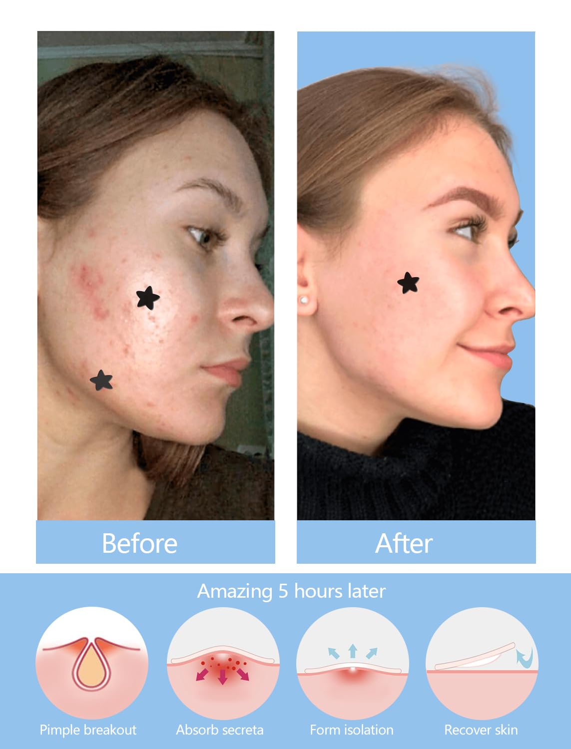 ZHAOLIESM night-use patch with strong adhesion during sleep
