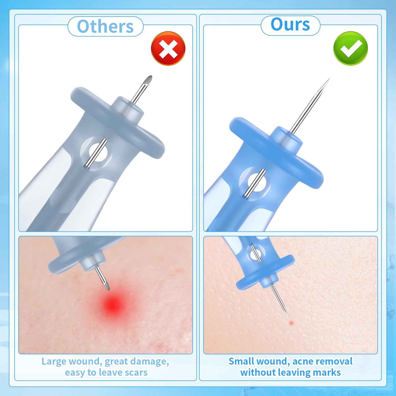 ZhouBoat at-home care concept shows convenient blemish treatment