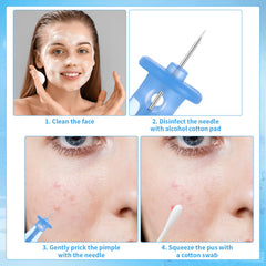 ZhouBoat closeup of sterile needle tip highlights precision for blemish removal