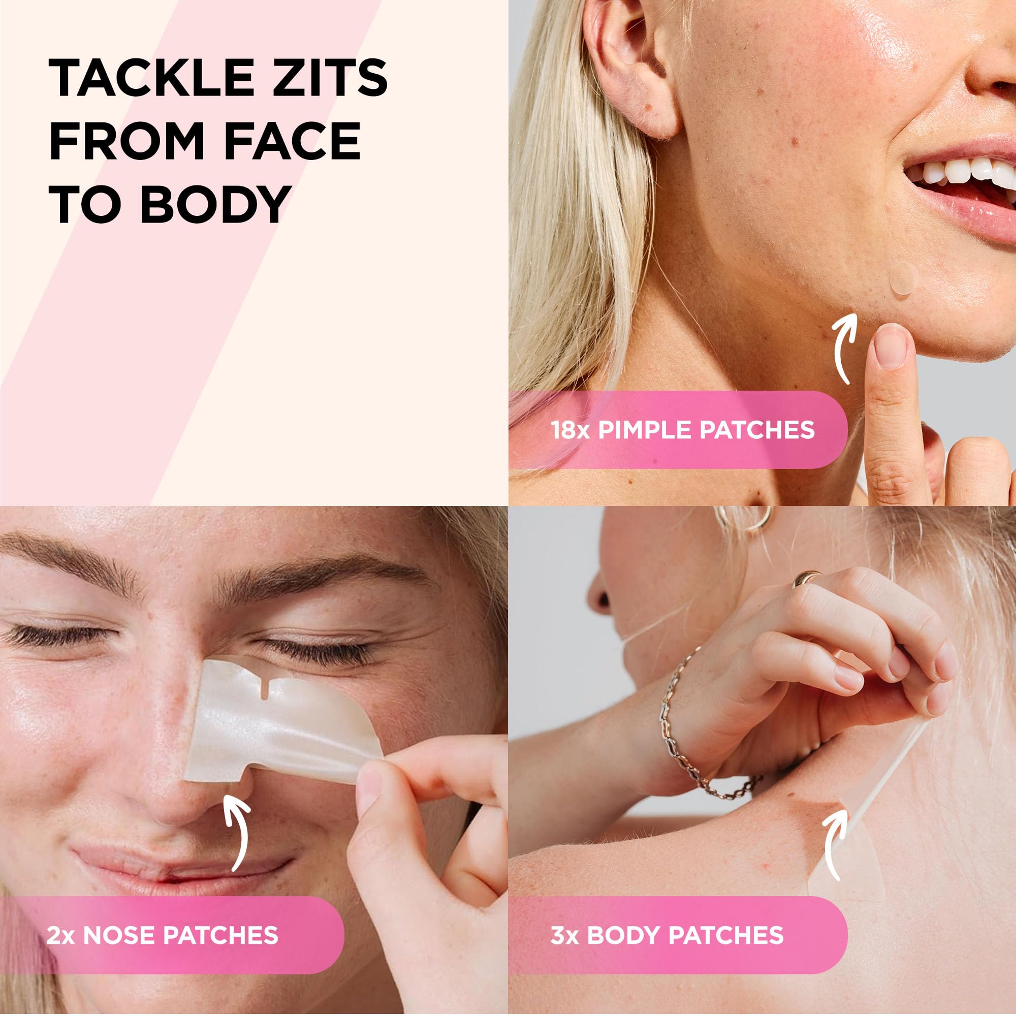ZitSticka Goo Getter patches applied to zit on the face