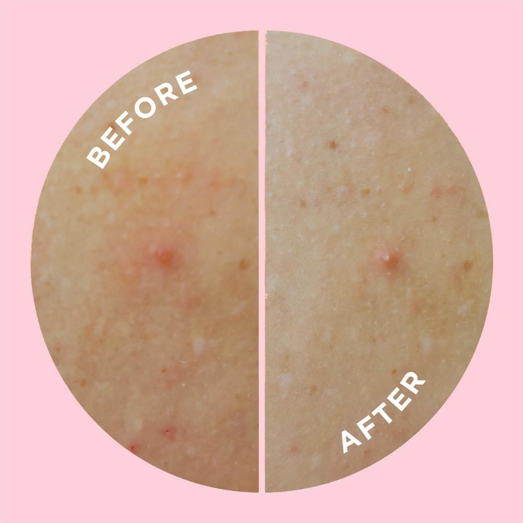 Goo Getter supports gentle skin renewal as you go about your day.
