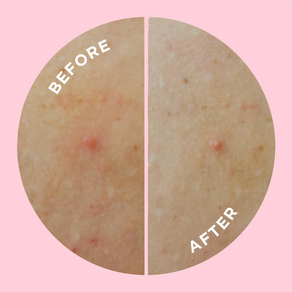 Goo Getter supports gentle skin renewal as you go about your day.