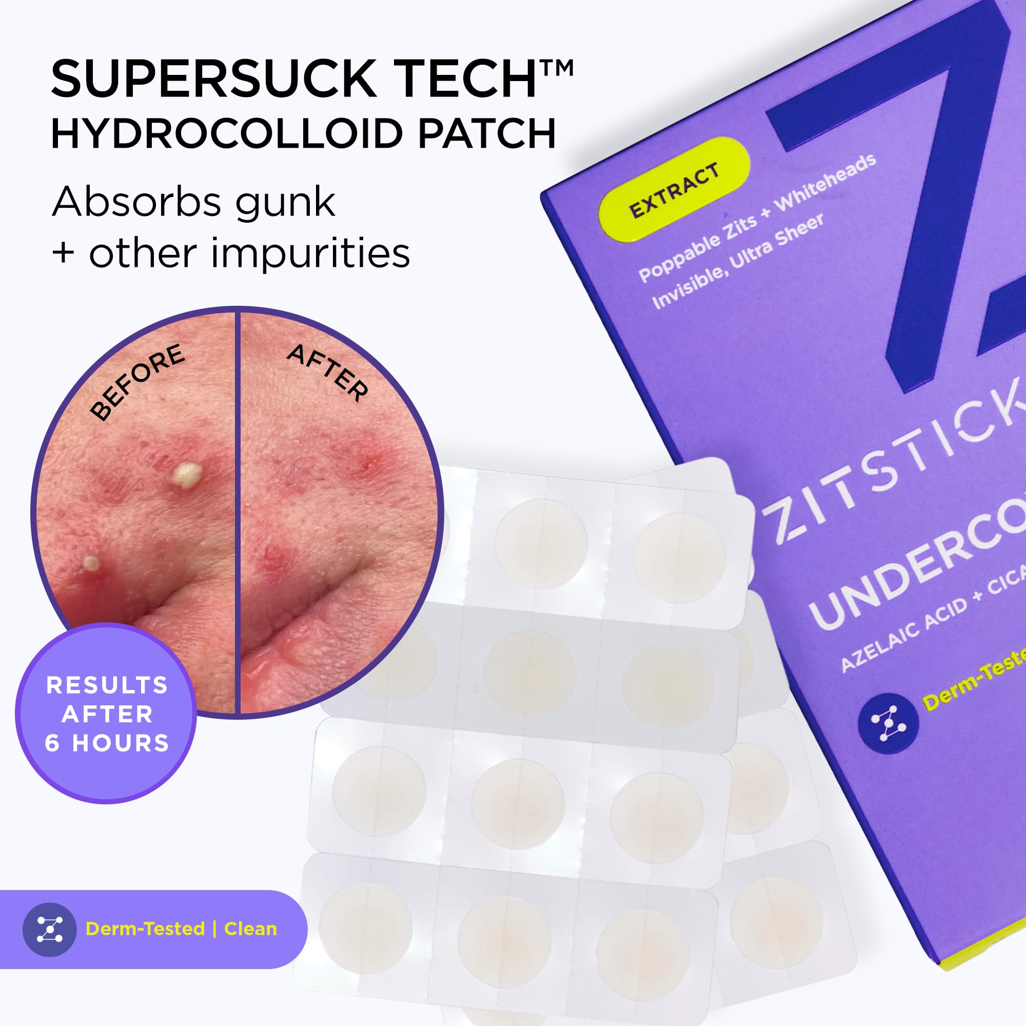 Ingredients like tea tree, cica and azelaic acid highlighted on packaging.