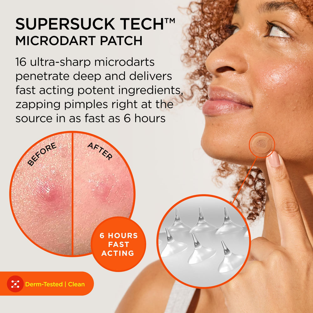 ZitSticka Killa Mini microdarts closeup delivering actives to skin.