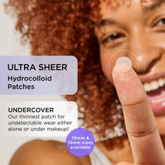 ZitSticka invisible patches applied on skin for makeup-friendly wear
