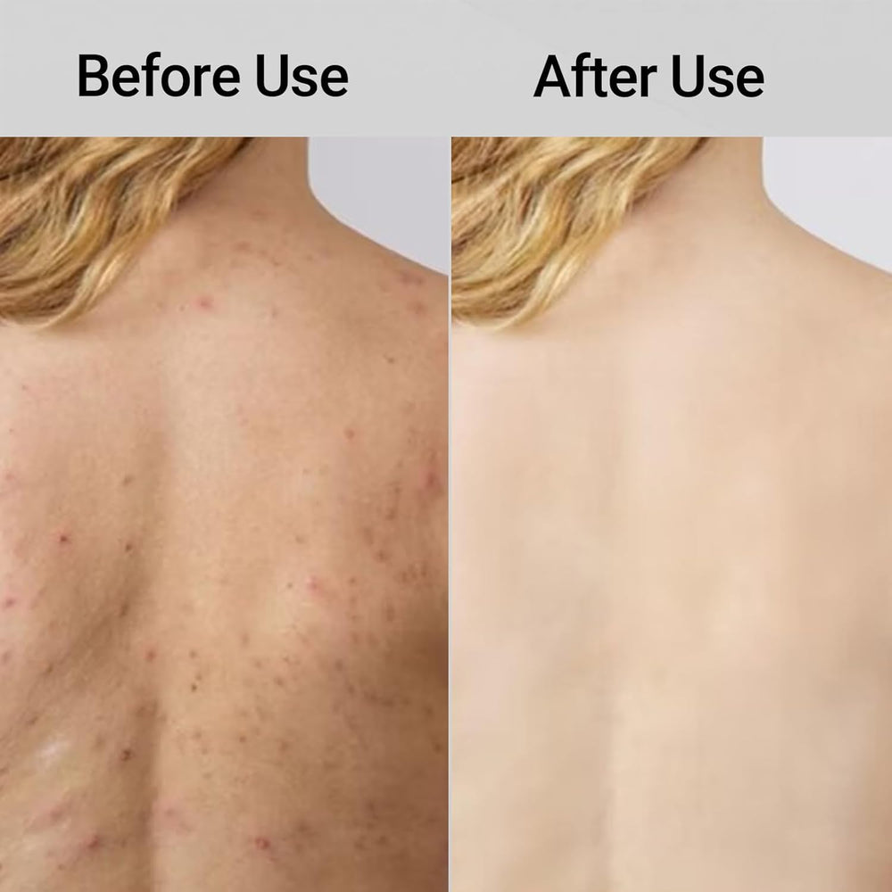 ZIVWAGX Exfoliating Shower Towel soft-skin focus helps with spa-like routine