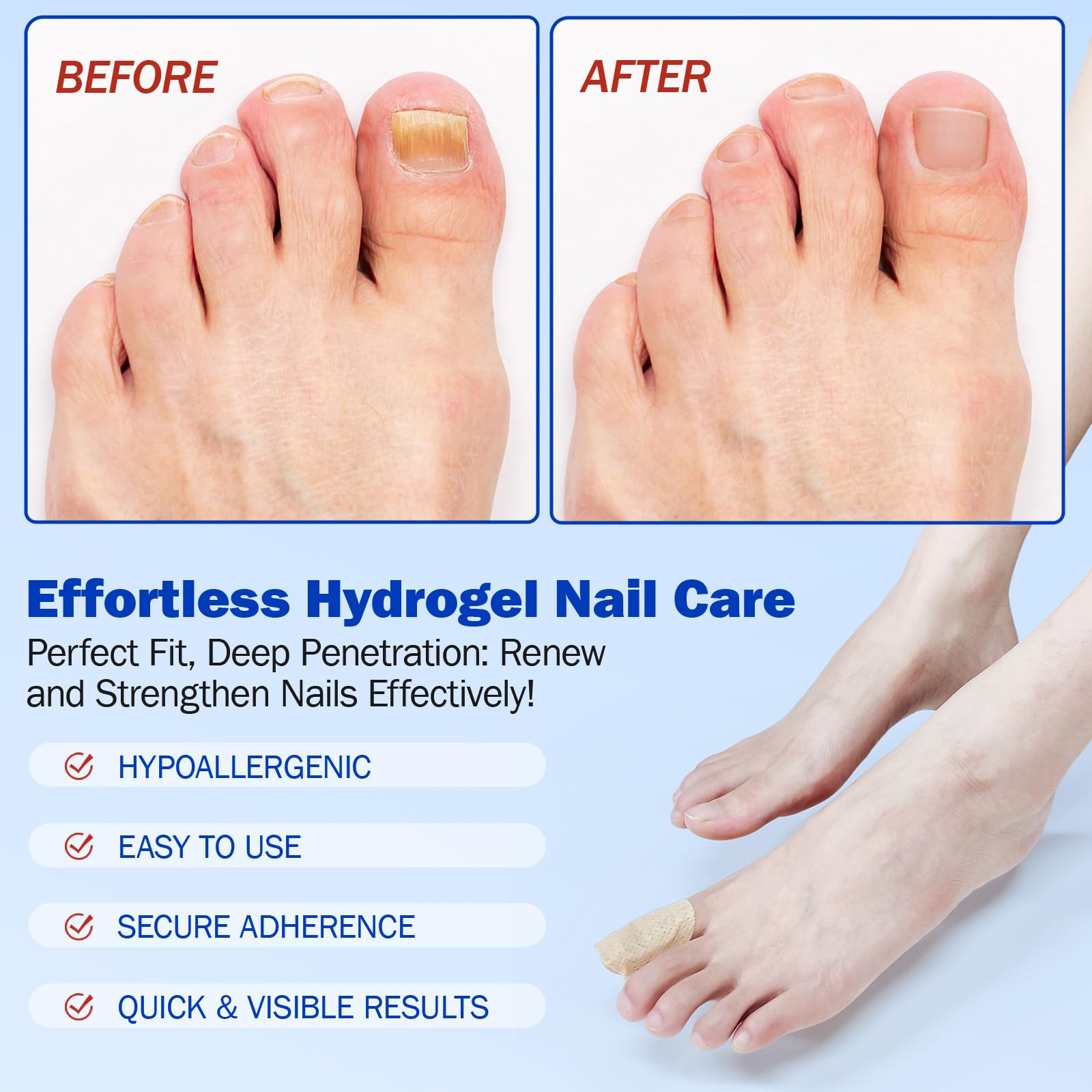ZIXBMHYJ nightly care scene demonstrates overnight softening and visible improvement.