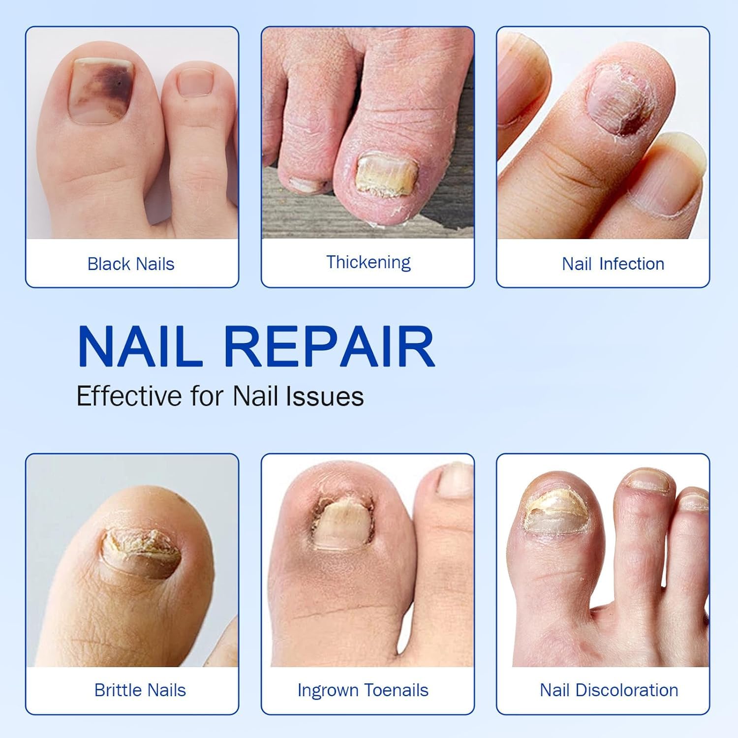 ZIXBMHYJ patches applied on nails to improve texture and thickness.