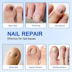ZIXBMHYJ patches applied on nails to improve texture and thickness.