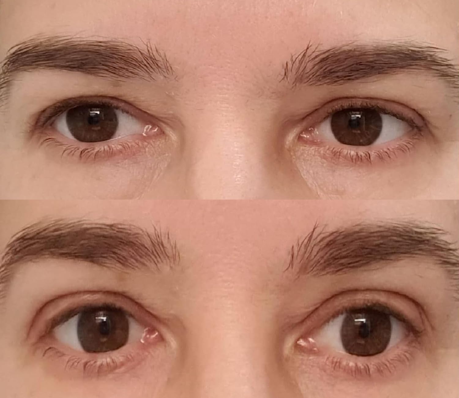 ZMBeautk fork sticks aid crease alignment during lift.