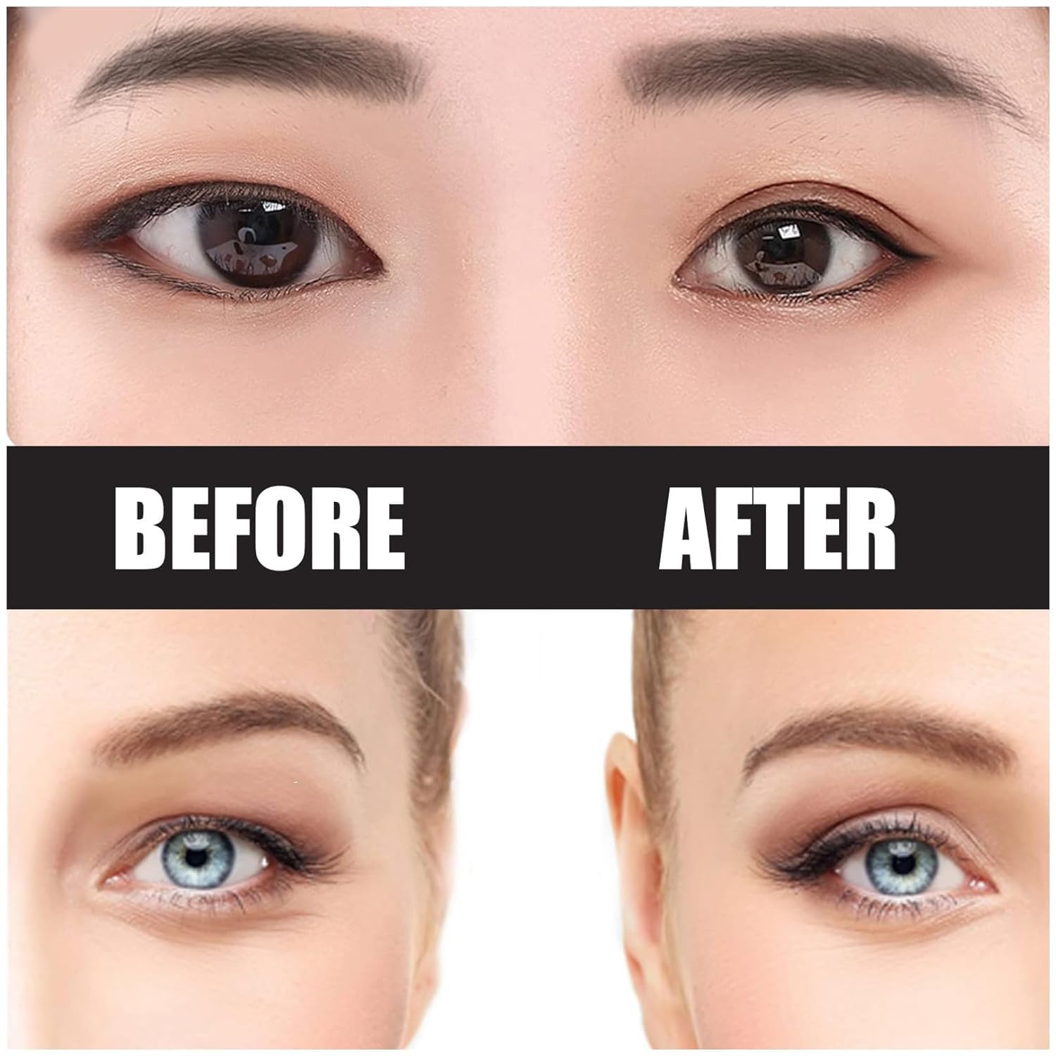 ZMBeautk natural-looking lift enhances eye shape discreetly.