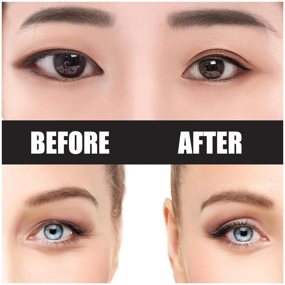 ZMBeautk natural-looking lift enhances eye shape discreetly.