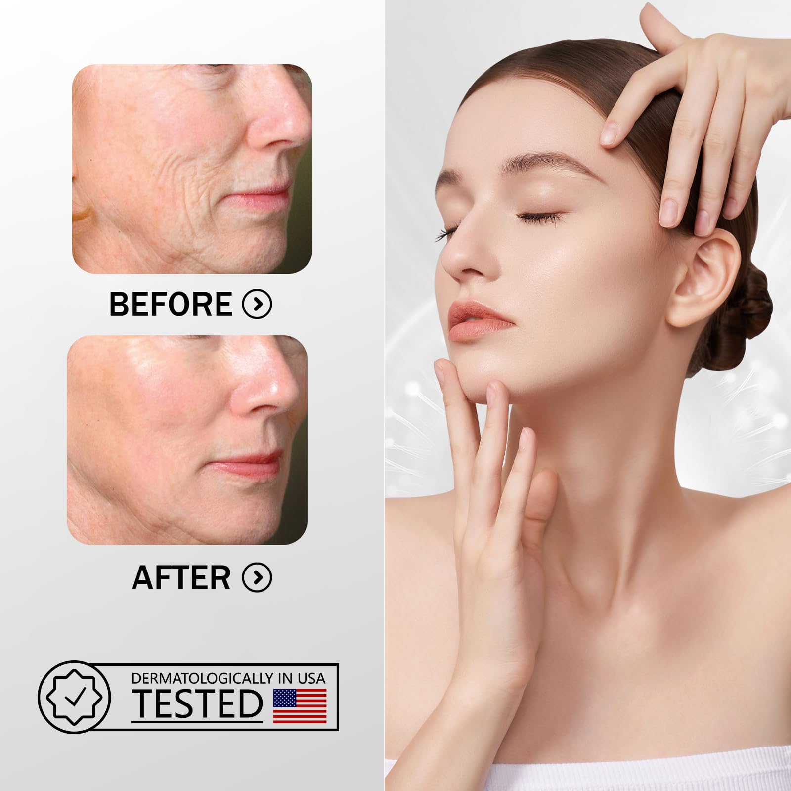 ZMBeauty smile line remover pad on skin with subtle lift.