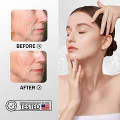 ZMBeauty smile line remover pad on skin with subtle lift.