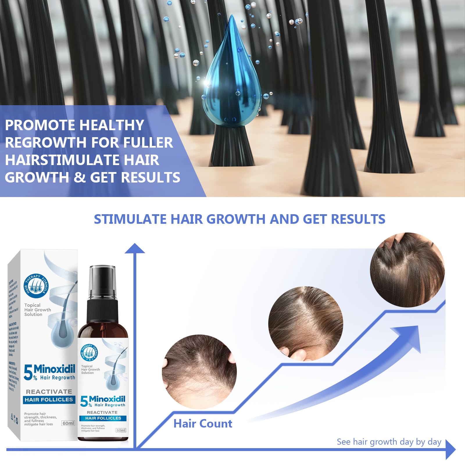 ZVBZVB Minoxidil packaging box highlights brand and product details.