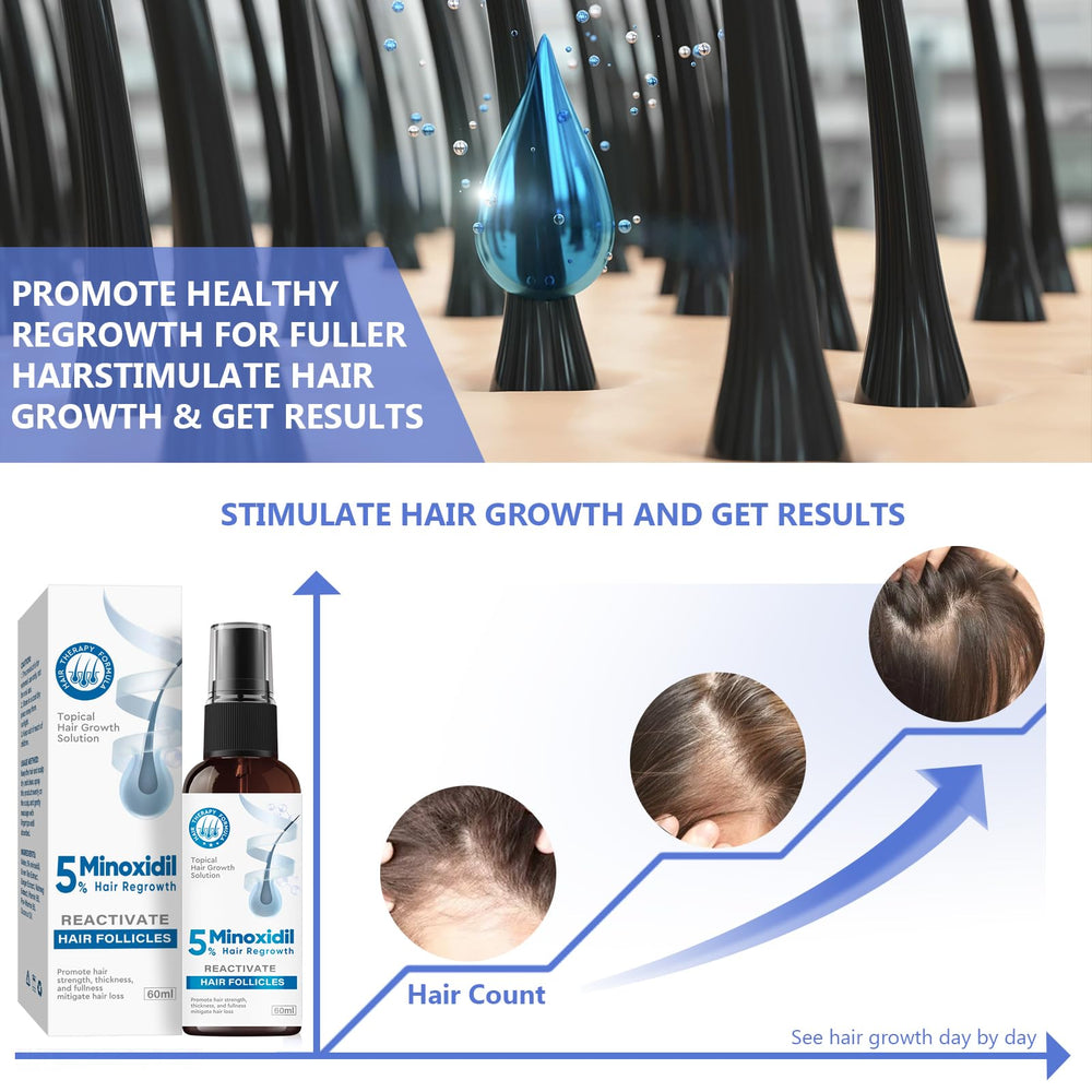 ZVBZVB Minoxidil packaging box highlights brand and product details.