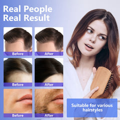 ZVBZVB Minoxidil spray on scalp demonstrates targeted thinning-area application.