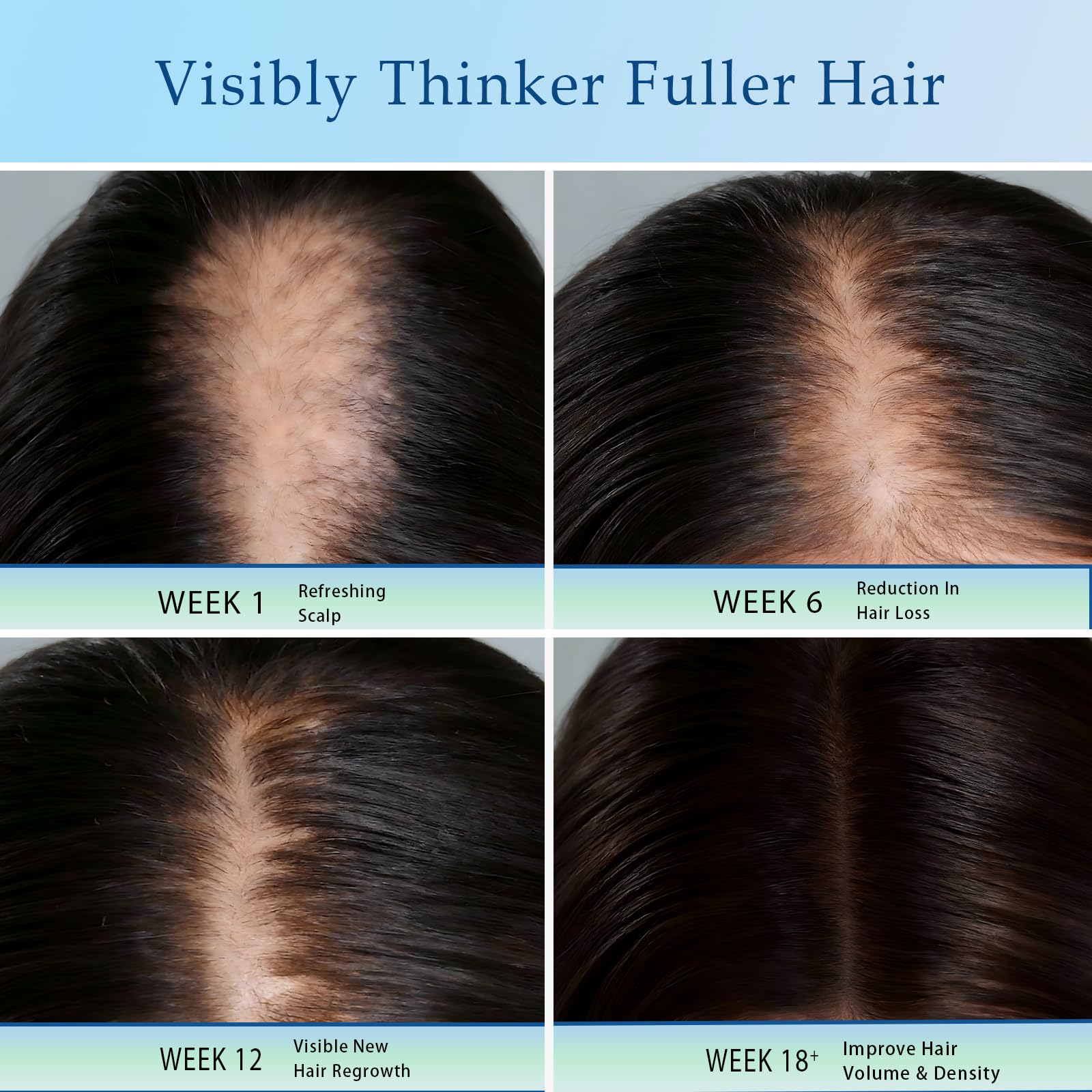 ZVMHSPP gentle on scalp serum suitable for sensitive scalps.