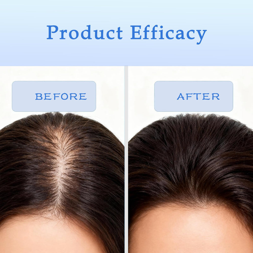 ZVMHSPP portable hair density serum for on-the-go care.