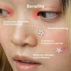 ZVYK pimple patches flower designs add charm while concealing breakouts