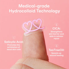 ZVYK pimple patches ribbon designs express style while absorbing excess oil