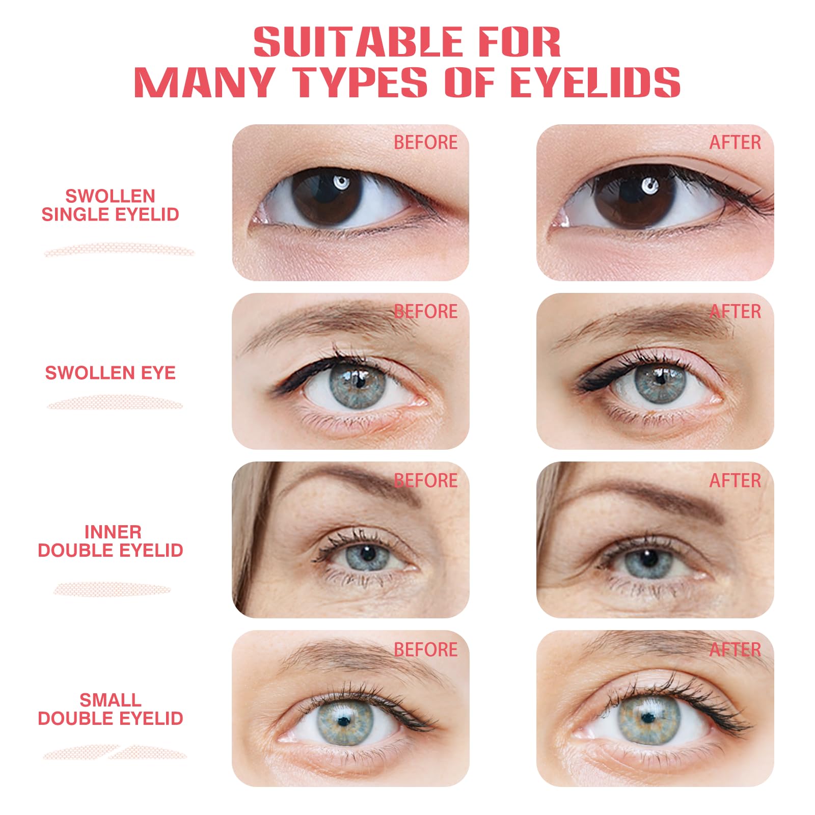 ZYQTQZ breathable hypoallergenic tape gentle on sensitive skin