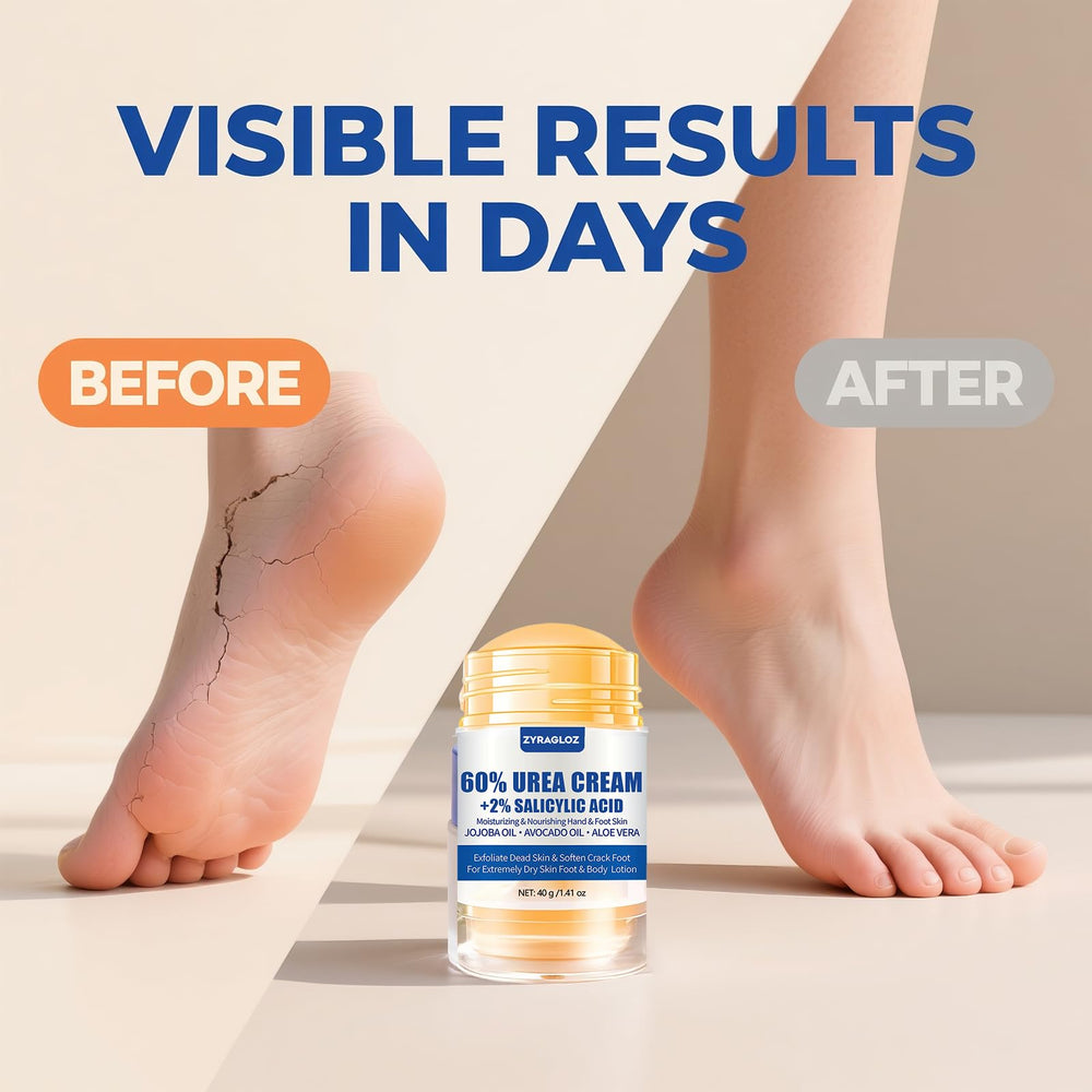 ZyraGloz Urea Cream Stick on feet demonstrating softening and moisture lock.