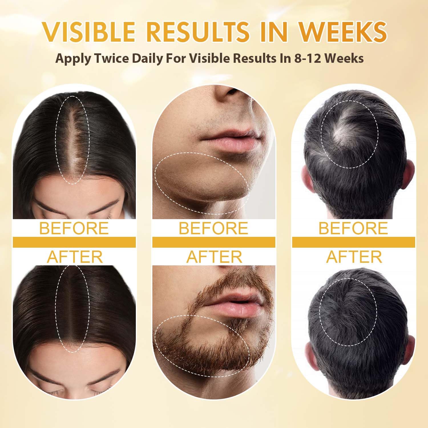 Close-up shows scalp application with quick-drying formula.