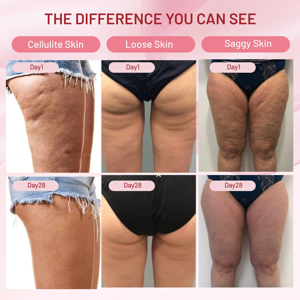 ZZILME caffeine-boosted firming illustration suggesting gentle toning for legs.