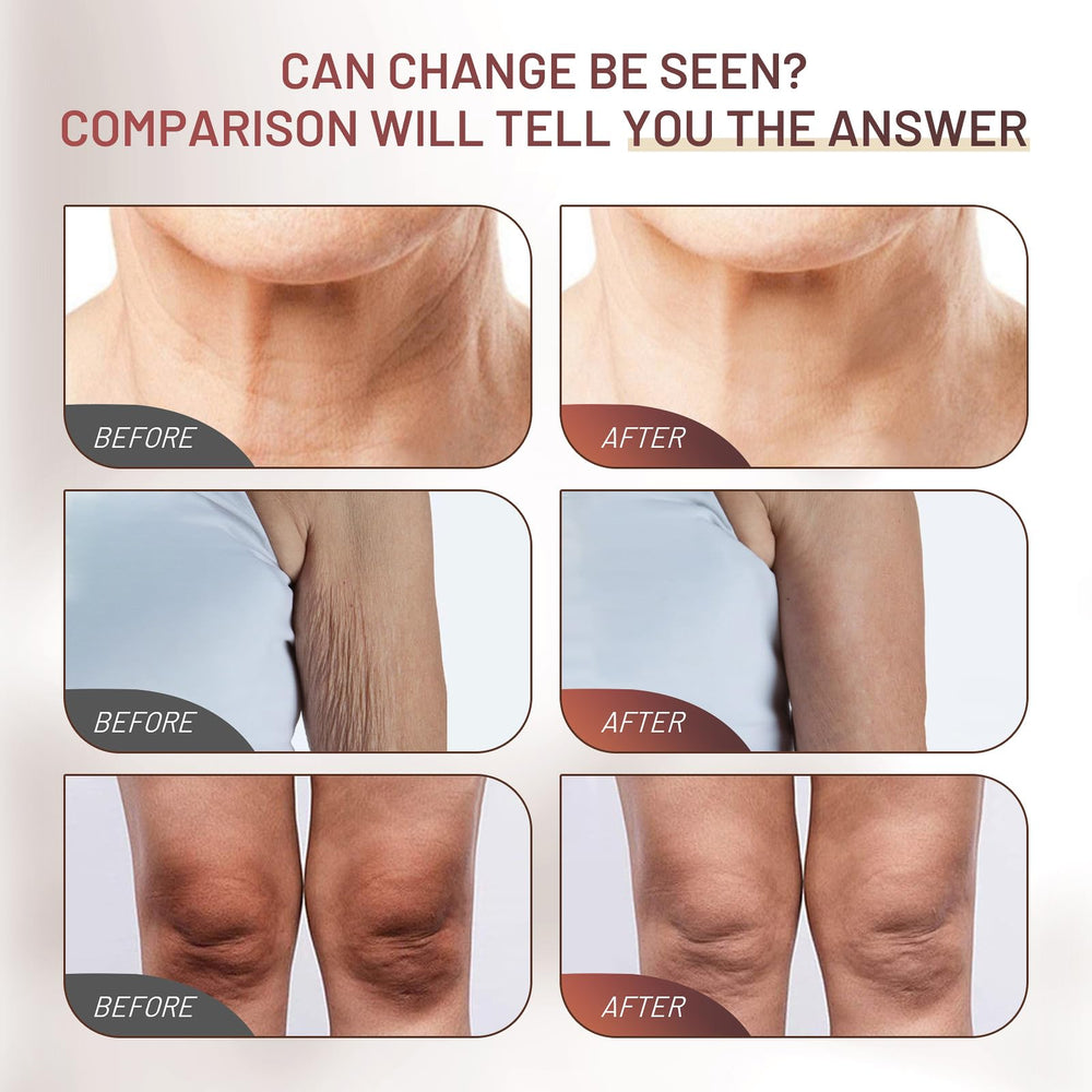 ZZILME Crepe Fix Cream on arms for toned, elastic skin.