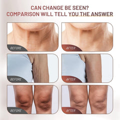 ZZILME Crepe Fix Cream on arms for toned, elastic skin.